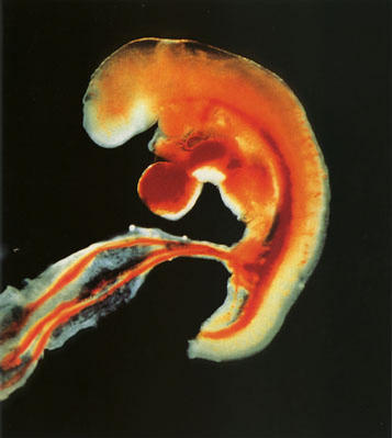 组图:窥探精子与卵子结合至受孕全过程(2)_科学