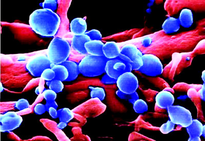 科技时代_禽流感病毒攻击人体健康细胞照片曝光(组图)