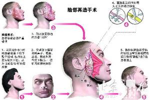 科技时代_中国换脸手术正在秘密进行 费用至少20万元