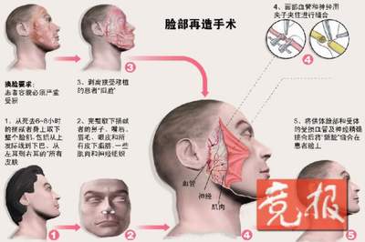 科技时代_北京选定换脸第一人 中国难求捐脸人(组图)