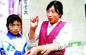 科技时代_2005中国十大科技骗局之五:甘肃农妇胳膊长字