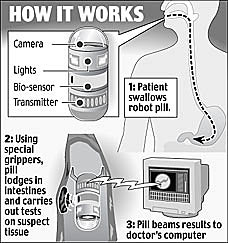 科技时代_英国发明药片机器人 可吞入腹中检查癌症