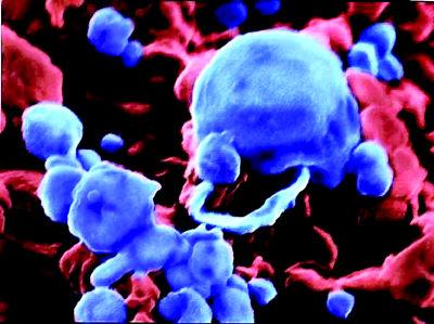 禽流感病毒攻击人体健康细胞照片曝光(组图)
