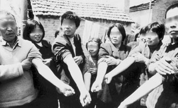 艾滋病才是真正的大规模杀伤性武器(1)