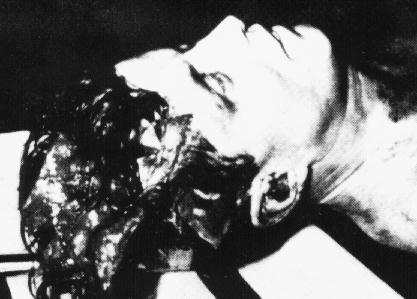 肯尼迪尸检照片枪声响起的瞬间镜头联邦特工克林特·希尔不由自主地