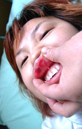 中国女士被日本人殴打续:施暴日本男子有意道
