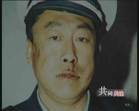 山西文水交警执法被自己领导打伤事件调查(图