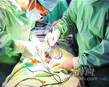 中山三院肾移植微创手术成功(图)