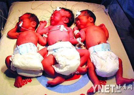 三胞胎试管婴儿在牡丹江出生(图)