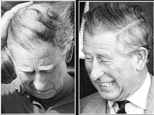英国媒体称查尔斯秘密植发救秃顶(图)