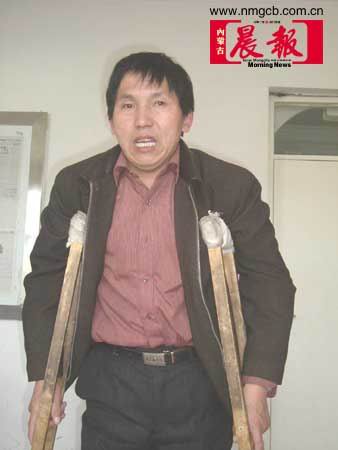包头一农民工为讨工钱被砍致残(图)