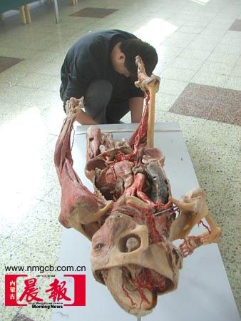 图为哈根斯的人体标本展览.