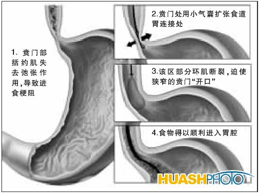 女子喝稀饭须蹦跳才能咽下(图)