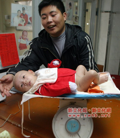 透明男婴出院1岁后可接受生命之光救助