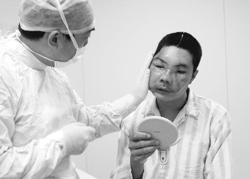 4月25日,中国首位"换脸"人李国兴在陕西省西安市西京医院接受检查.