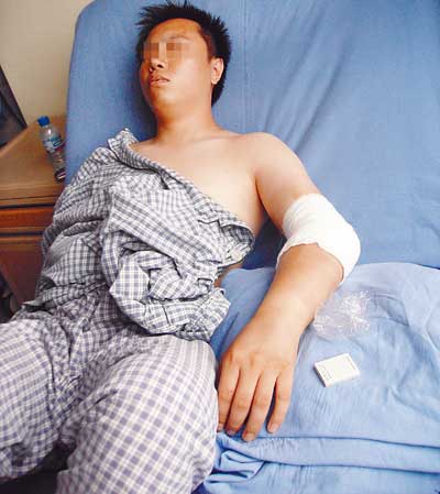 淇淇的男友小余左胳膊肘被打骨折.