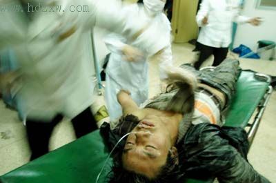 石狮一电镀污水处理厂雇无资质工人清淤熏倒三人; 急性中毒的急救通则