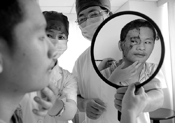 17岁江西青年吴有明在上海时光整形外科医院