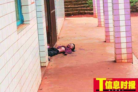仅10岁的二年级学生吴喜宁,头上被砍忠换刀
