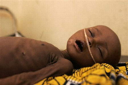 组图：非洲尼日尔饥饿瘦弱的儿童