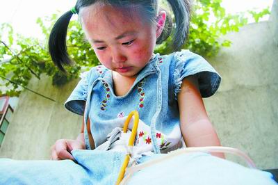 遭遇车祸,5岁女孩挂着尿瓶度日 三五万元手术