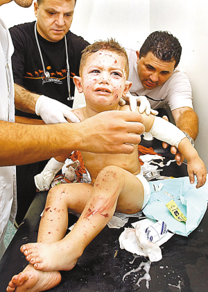 图为一名被炸伤的黎巴嫩儿童在接受治疗.