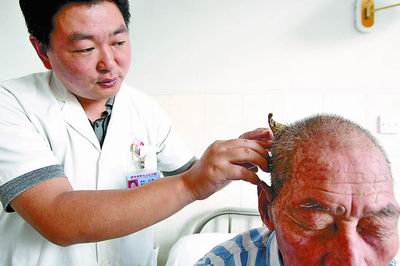 88岁老人头上长个犄角医生确认是角质化肿瘤