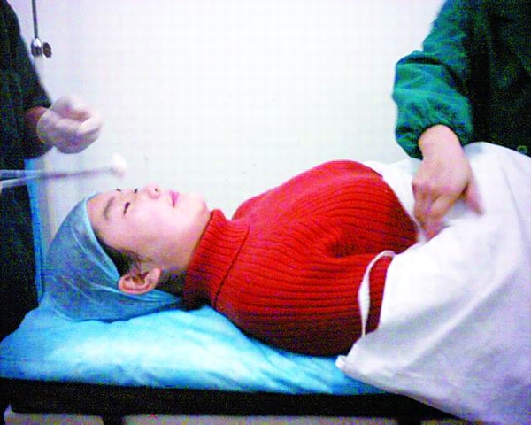 宜昌三峡人造美女初次手术成功(组图)
