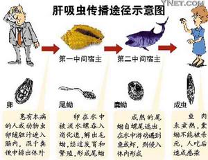 佛山市疾病控制部门获悉,佛山有超过100万人由于吃鱼生感染了肝吸虫病