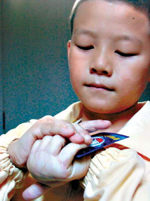广州11岁男孩手指可反转 手背一扳压碎鸡蛋(图
