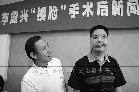 小伙李国兴被黑熊咬伤面部后,到西安做了国内首例,世界第二例换脸手术