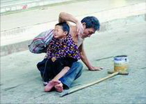 男子铁链拴住盲童行乞 网友疑其双眼被故意弄瞎