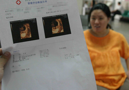 医院用彩超给胎儿拍照涉嫌变相鉴定胎儿性别