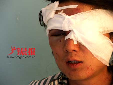 内蒙古晨报记者在歌舞厅内拍照遭殴打(组图)