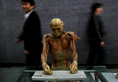 组图:博物馆真人标本展示电脑对人体危害