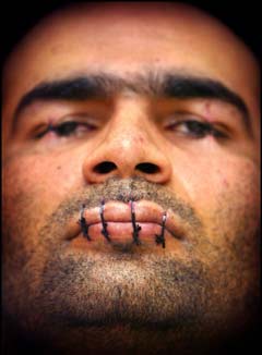 一名伊朗避难者缝起眼睛和嘴巴以示抗议.