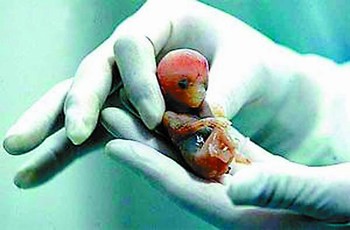 的婴儿胚胎已在母体中着床