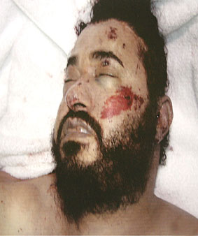 图为美军方昨公布的扎卡维被打死后的尸体照片. 新华社/路透