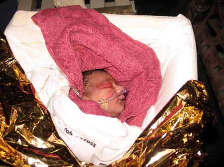 班牙救援队合作为一名巴基斯坦难产孕妇分娩(