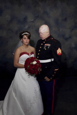 图文:受伤的美军海军陆战队员回国结婚(肖像类