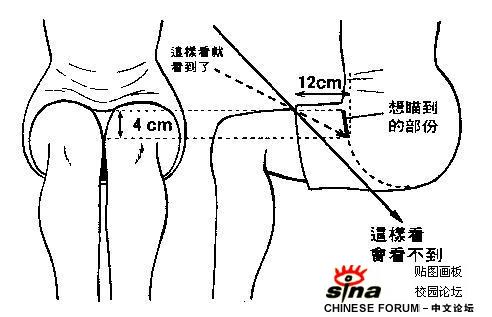 自缚图解