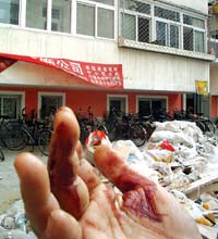 被打女业主鲜血淋淋的手.实习生刘刚摄