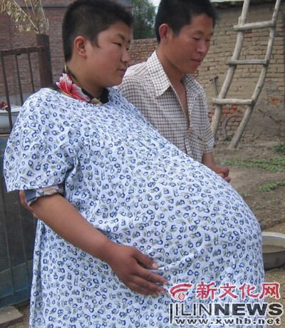 五胞胎孕妇产前大肚子图片