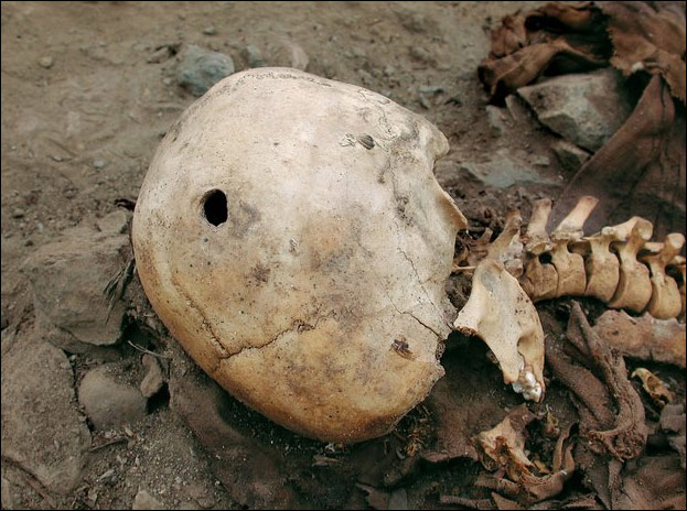 秘鲁惊现500年前尸骸死者均被枪杀组图3